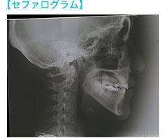 セファログラム