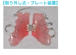 取り外し式プレート装置