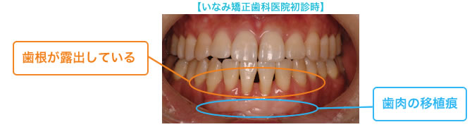 いなみ矯正歯科医院初診時