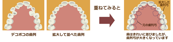 不十分な診断による治療