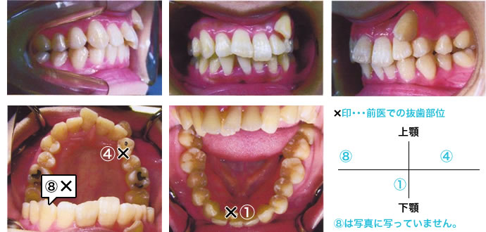 再治療前の写真