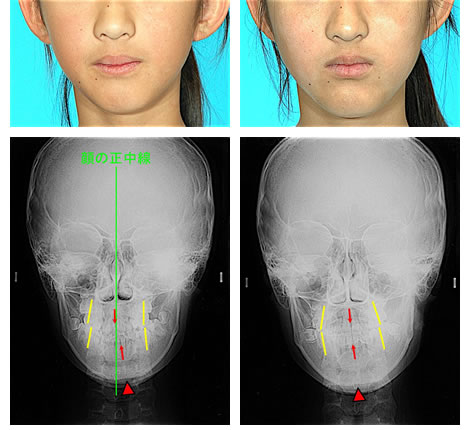 治療後の症例写真