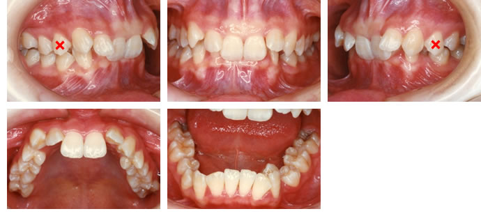 治療前の症例写真