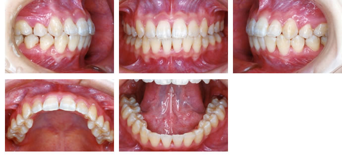 治療後の症例写真