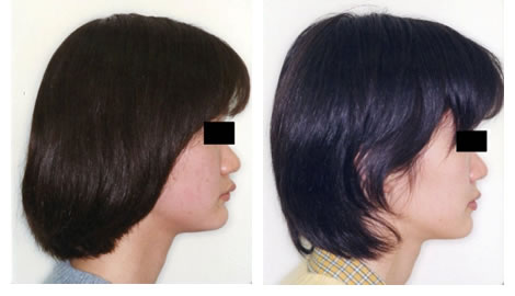 治療後の顔貌の変化