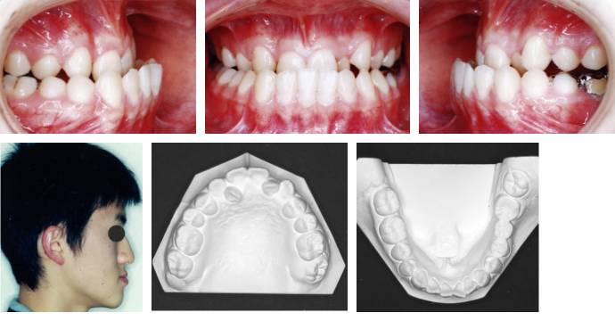 治療前の症例写真