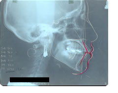 セファログラム