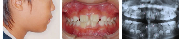 初診来院時の診察