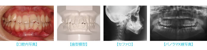 矯正治療前の検査