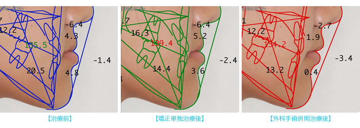 外科手術のシミュレーション