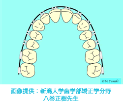 ストレートエッジワイズ法